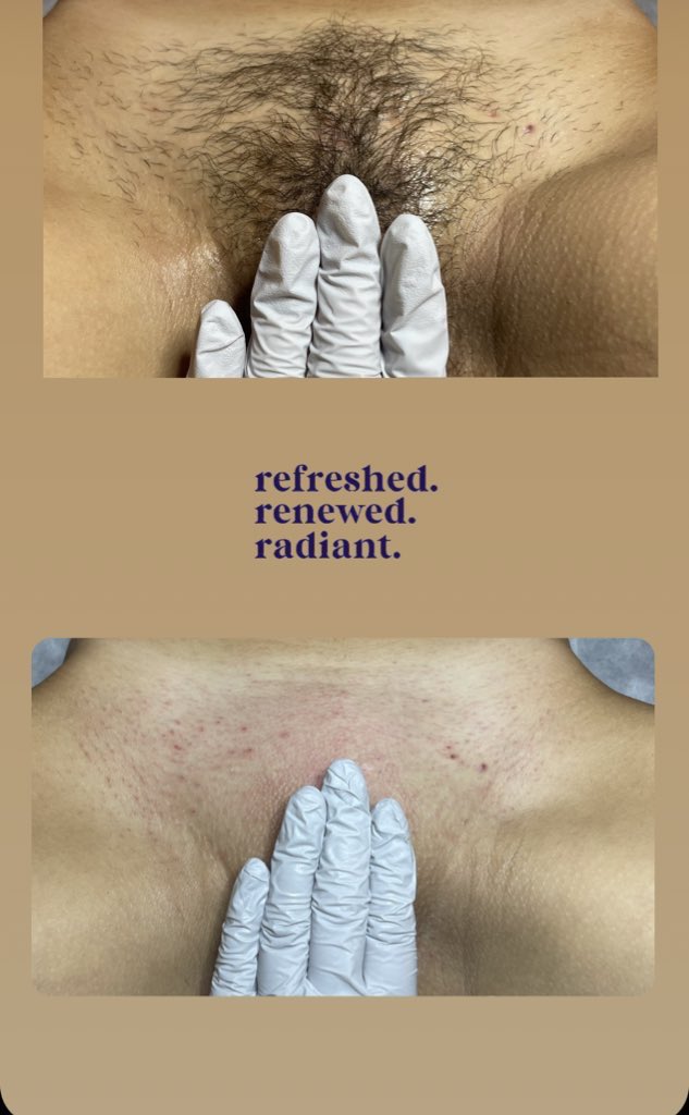 HoodSthetics's tweet photo. I know a lot of y’all are way past a wax / Facial 

That being said, Books are open &amp; late night Service is available with a small up-charge.

If you have any questions , please ask away 💜 https://t.co/gGht4sTDSq