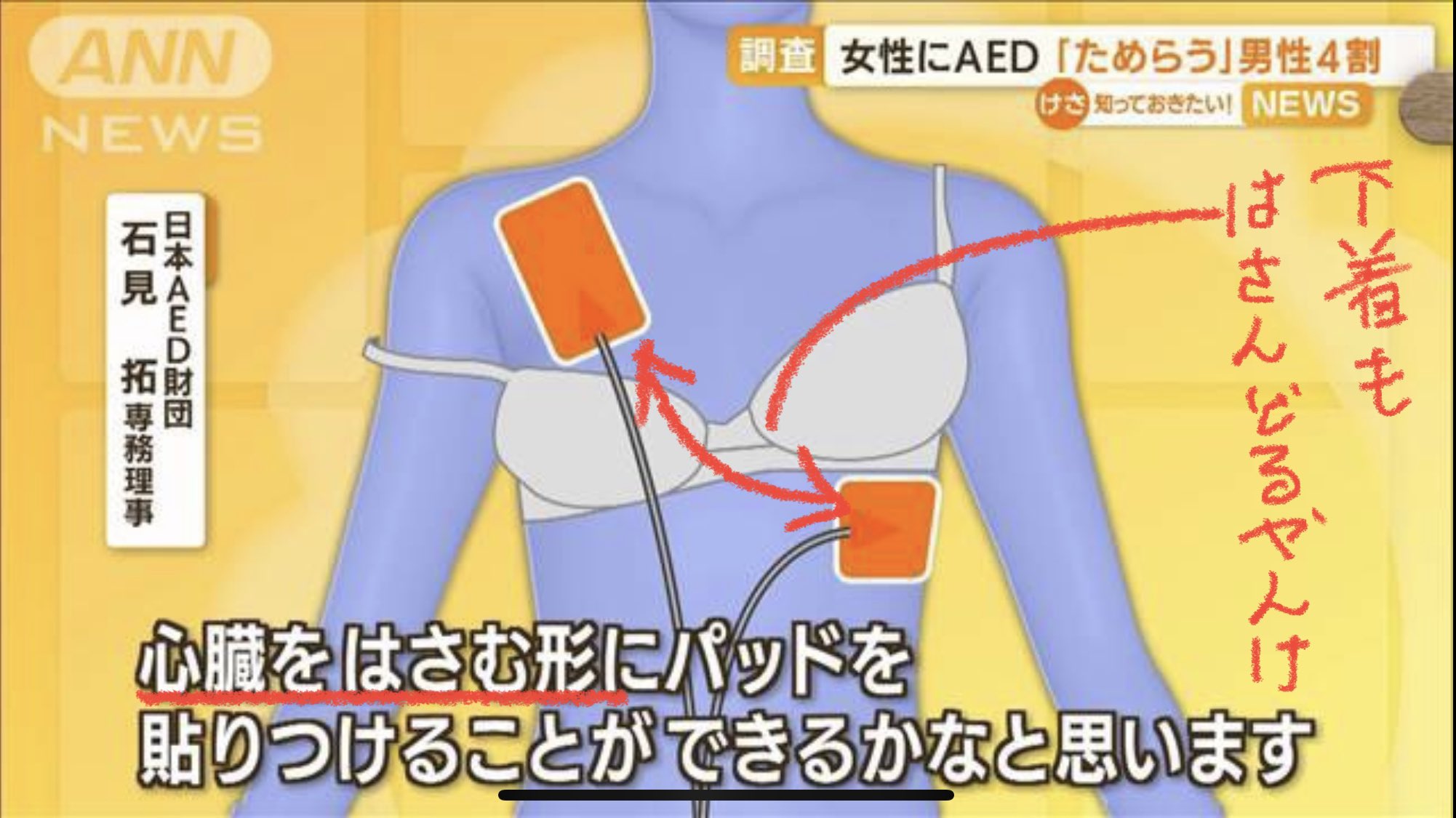 AED 女性 女性へのAED使用問題の原因の一部に 心臓を（オセロみたいに）挟め  ※下着のワイヤーやネックレスなどの金属を（パットの下に重ねて）挟むな するべき『挟む』と しちゃダメな『挟む』  これが口頭で伝わりにくいってのがあると思う。 会社での消防士さんから ...