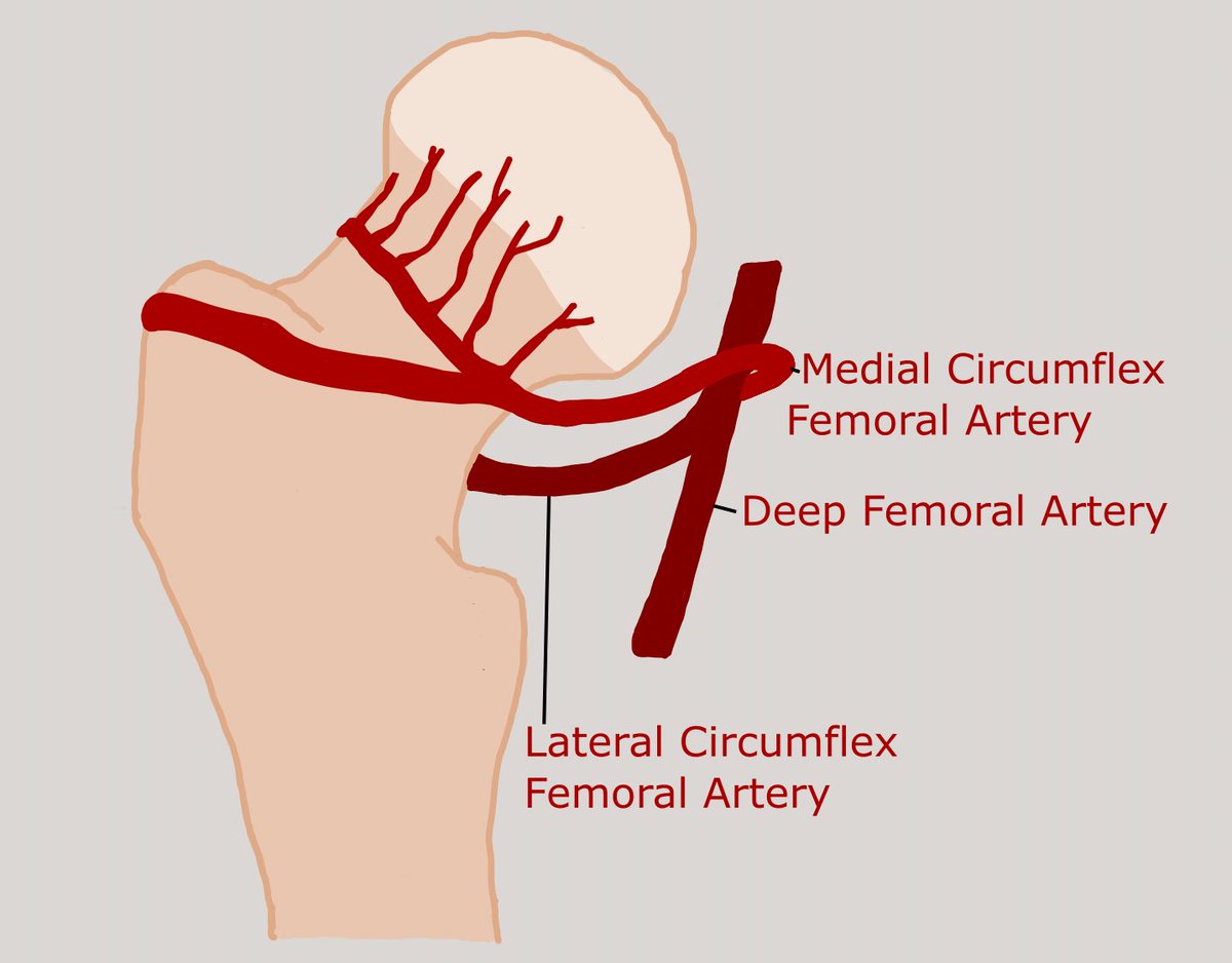 orthoEMpearls's tweet image. Did you catch this Pearl from this week’s case? #FOAMed #FOAMrad #emergencymedicine #sportsmed

PEARL: Xray has a 90-98% sensitivity for proximal hip/pelvic fractures. If you have high suspicion and xray is negative, an MRI is considered the gold standard.