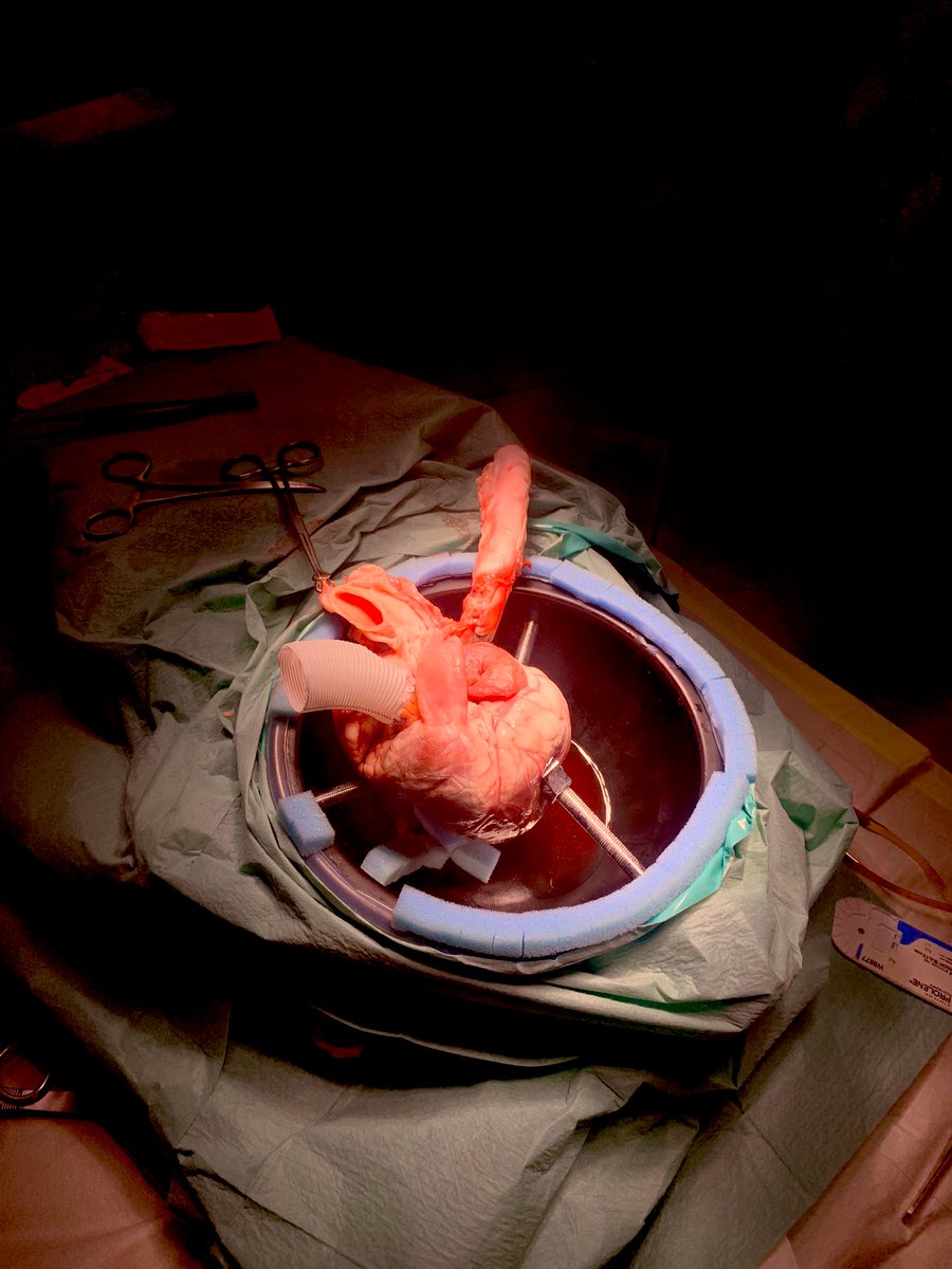 PatrickKennell7's tweet photo. Amazing day at the Irish Aortic Dissection Symposium ! A fantastic learning opportunity following my cardiac surgery elective this summer @RCSI_Irl @RCSI_SIM #aorticdissection #simulation https://t.co/22ZuqaD11E