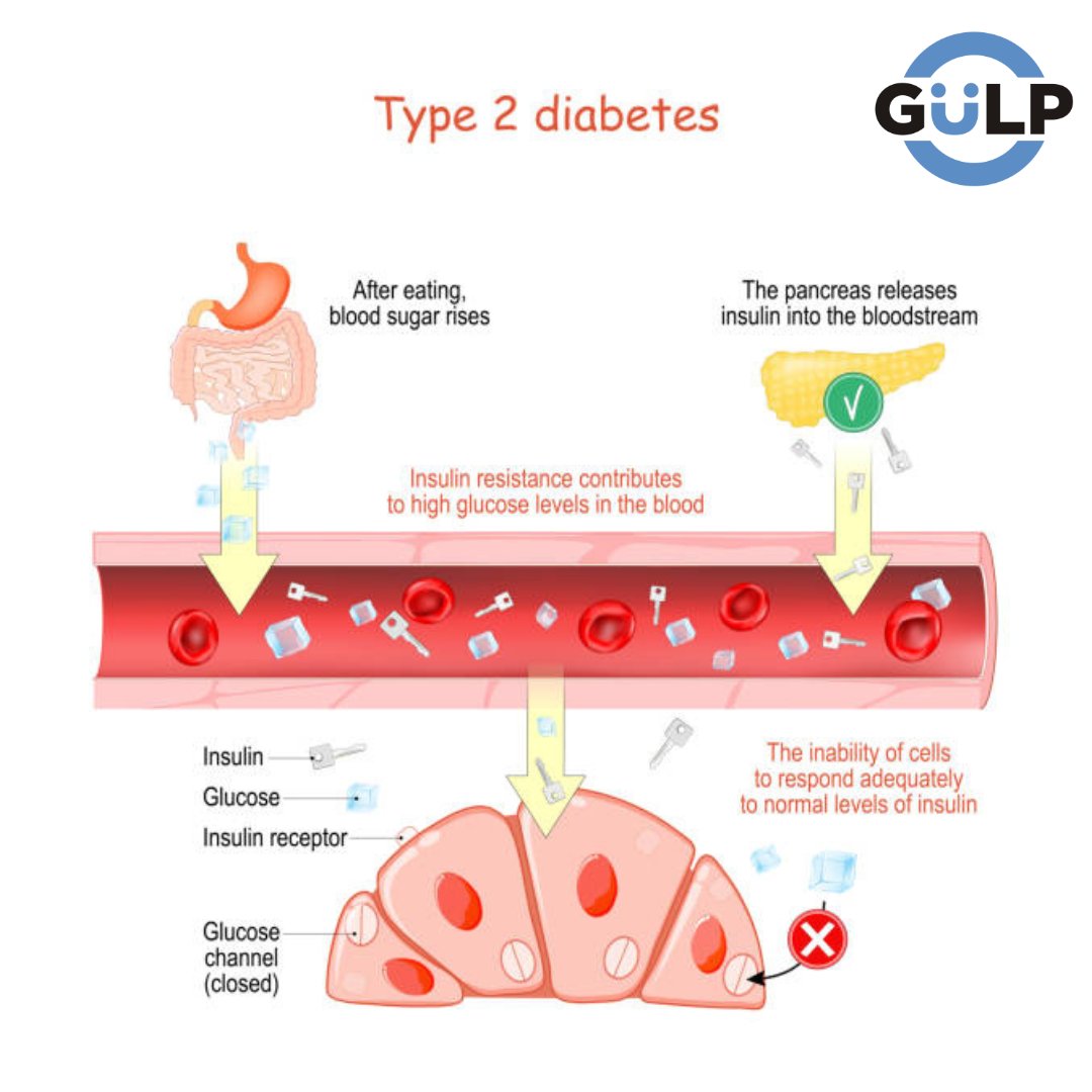 BluecirclePk's tweet photo. #sugarsugar #diettips #diabetesdiet #avoidjunkfood #weight #instagram #foryoü #sugarsugar #diettips #diabetesdiet #avoidjunkfood #weight #instagram #insulinresistance https://t.co/BwhrC2TaX1