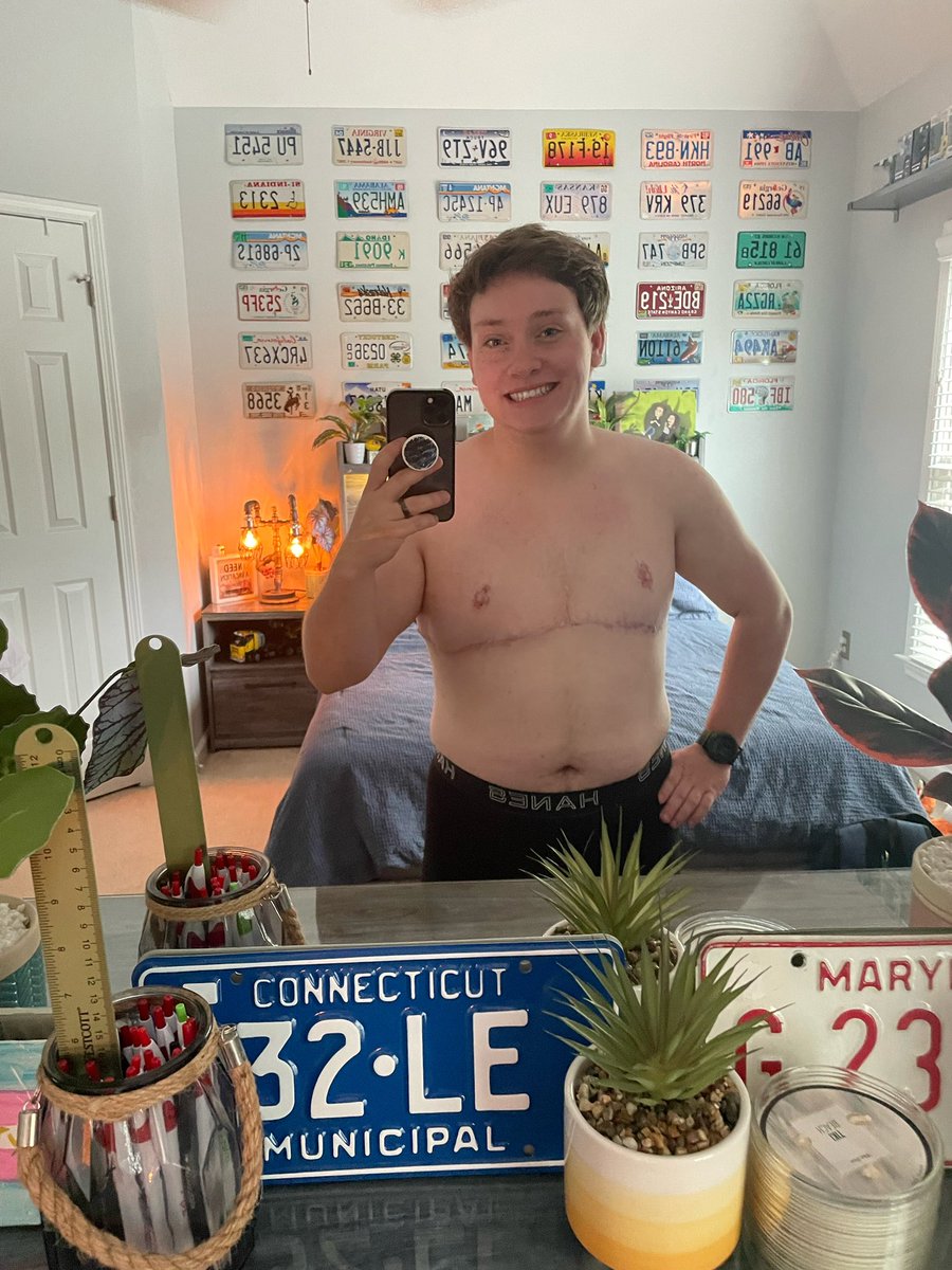 HamOnABicycle's tweet image. Today marks 1 year from when I got top surgery! So thankful to be here in this moment.