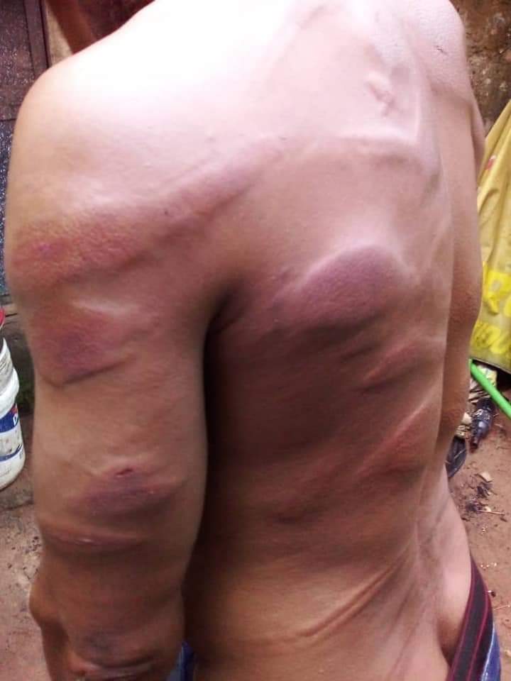 MaziUbaOfficial's tweet photo. WHY IS THE WORLD KEEPIN SILENT ON IPOB 😶
The reports also contain photos showing back of a man with many scars and injuries, purportedly inflicted on him by the @HQNigerianArmy and the security personnel @IntlCrimCourt
@UN_HRC @USAGov @10DowningStreet #FreeNnamdiKanu #BiafraExit https://t.co/JhAod9J9F0