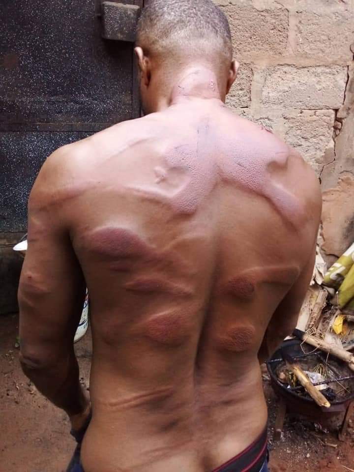 MaziUbaOfficial's tweet photo. WHY IS THE WORLD KEEPIN SILENT ON IPOB 😶
The reports also contain photos showing back of a man with many scars and injuries, purportedly inflicted on him by the @HQNigerianArmy and the security personnel @IntlCrimCourt
@UN_HRC @USAGov @10DowningStreet #FreeNnamdiKanu #BiafraExit https://t.co/JhAod9J9F0