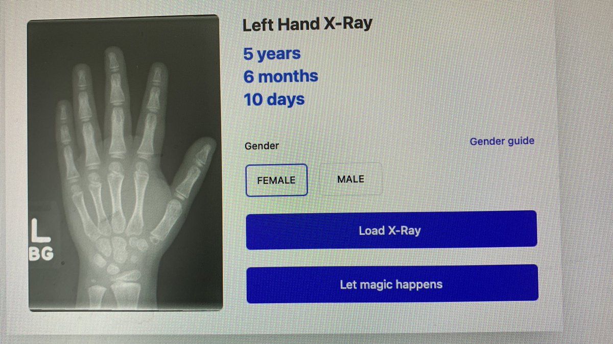 Biological age from X-ray image #AI #ArtificialIntelligence