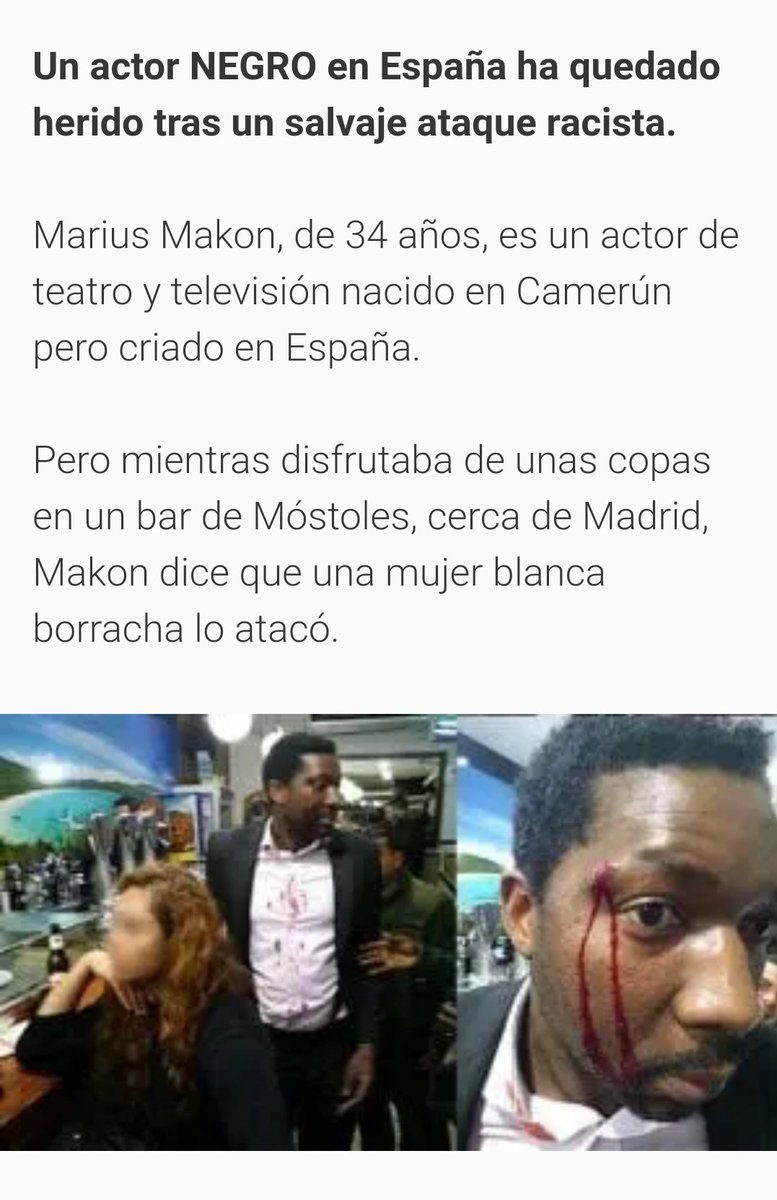 jotapez's tweet photo. 1000 RT (y subiendo) lleva esto que es una noticia falsa. 
La foto corresponde a un actor de Camerún por una agresión de 2018. https://t.co/nXcqeo48j2