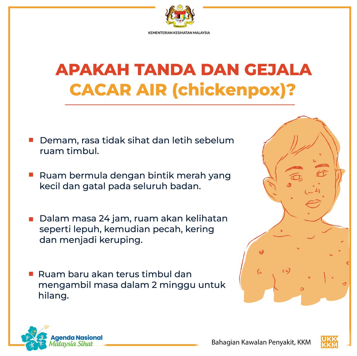 Kkmalaysia on twitter jangkitan cacar air atau lebih dikenali