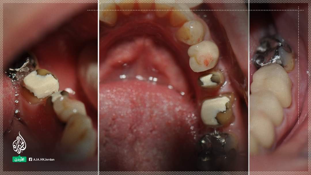 "أغسل أسنانك يوميًا".. قراصنة يخترقون هاتف رئيس الموساد الإسرائيلي، وينشرون صورًا لأسنانه، مصحوبة بنصائح طبية له، بأن يغسل أسنانه مرتين في اليوم، وذلك وفقا لموقع "والا" الإسرائيلي. وقال الموقع إن مجموعة القراصنة تطلق على نفسها "اليدان المبسوطتان"، و "يبدو أنهم مرتبطون ب #إيران"