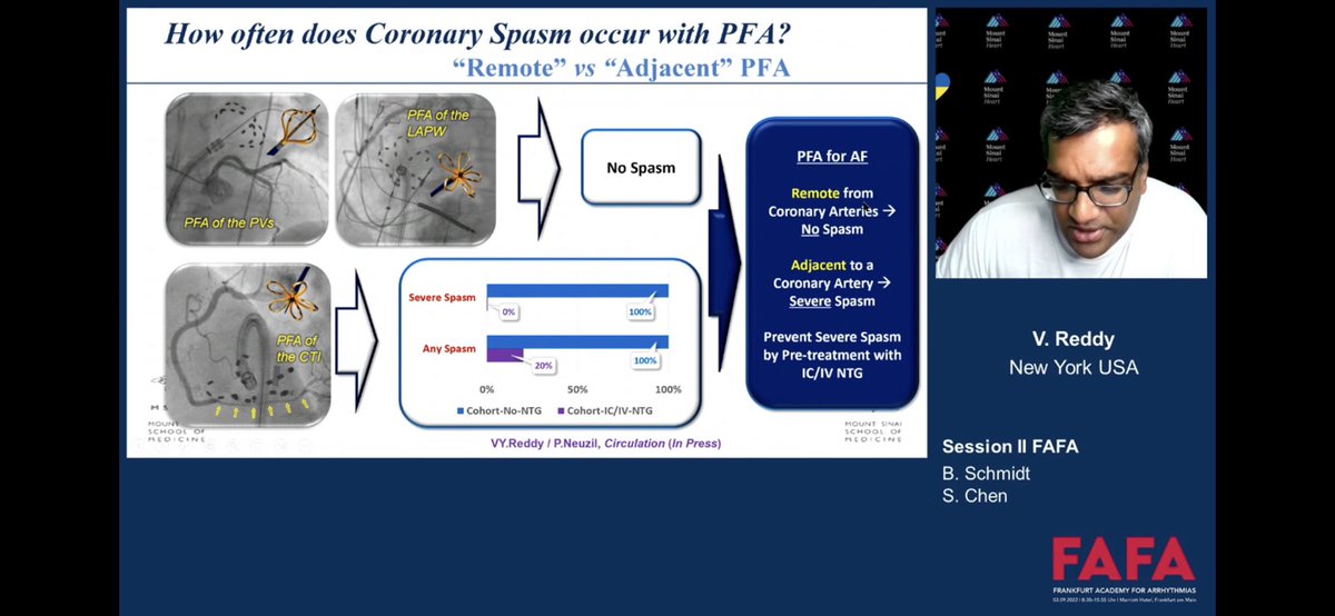 kottmaier_md's tweet photo. Great talk by @VivekReddyMD about PFA at #FAFA2022. 100% rate of coronary spasm of the RCA during CTI PFA 😨 luckily preventable by NTG application #AGEP #YoungDGK watch live at https://t.co/2tGPGrD9lU https://t.co/bEVGO6NvI8