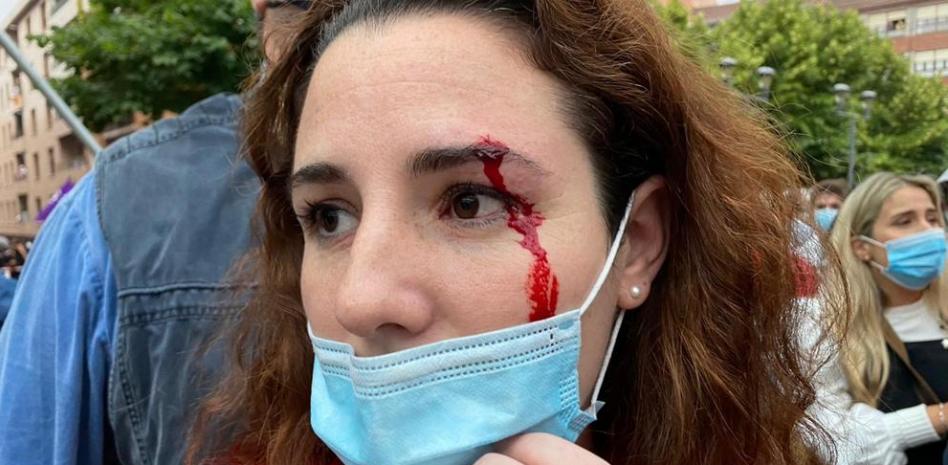 Josemarigudari's tweet photo. Recuerden la pedrada a Rocío de Meer negada por Echenique o el asalto en Vallecas justificado como "provocación".

La clásica doble vara de medir de la izquierda, que provoca el odio y se escuda en el victimismo. Las dos cosas al mismo tiempo. https://t.co/LnFTEd2xEJ