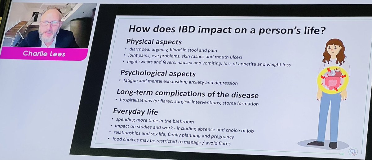 Siew_C_Ng's tweet photo. Insightful and practical. @charlie_lees speaking on optimising #IBD care at #iddf2022 #cuhk what do our patients want ? https://t.co/2Pm7kpGOct