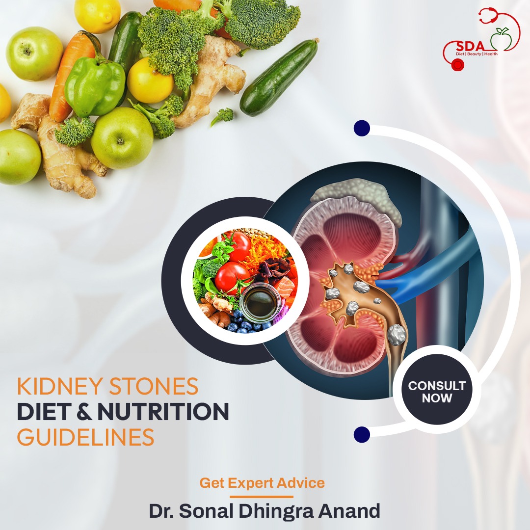 HealthSda's tweet photo. Kidney stones
Diet and Nutrition Guidelines
Get Expert Advice by #Dr_Sonal_Dhingra_Anand
call now : 09711466123
#SDA #Diet #Health #Beauty #NutritionWeek https://t.co/cMbqBJ0X8w