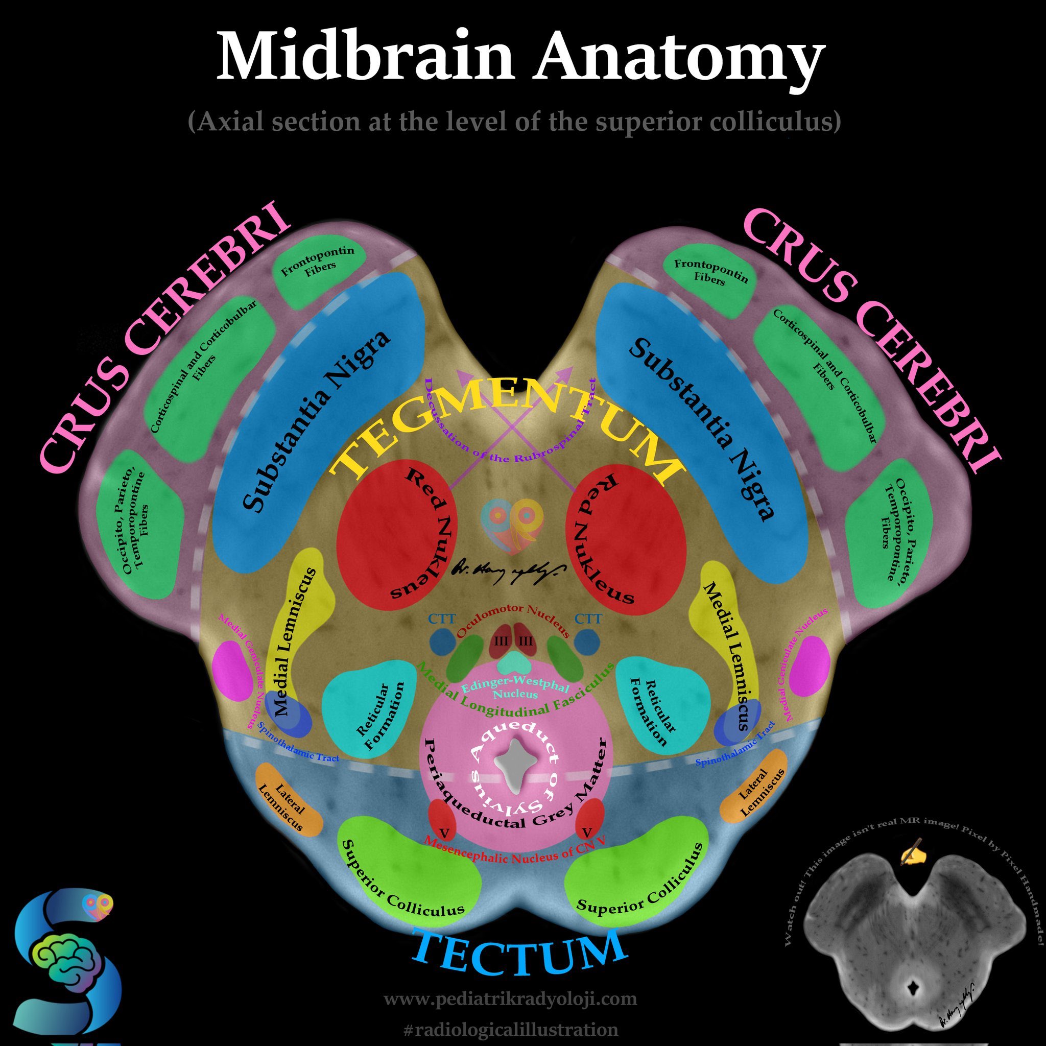 Oren Gottfried, MD on Twitter: "Great view of midbrain anatomy from ... Biology Diagrams
