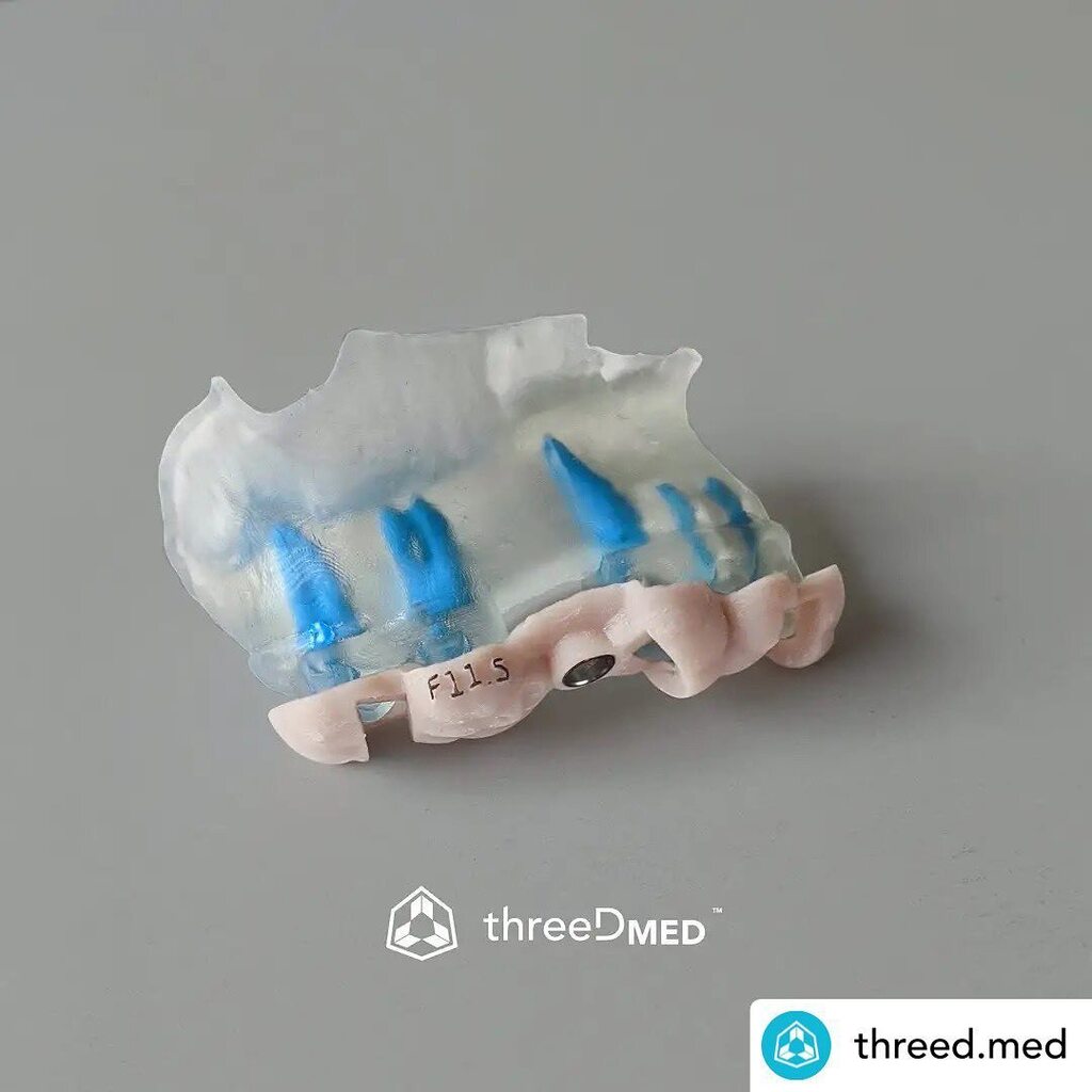 3dheals's tweet photo. #repost @threed.med Biomodelo para planificación pre quirúrgica de implantes.
#impresion3d #3dprinting #3dprintingmedical #biomedicalengineering #3dprintingdental
#odontologiadigital #digitaldentistry #guiaquirurgica #surgicalguide #surgicalplanning #anatomicalmodel #cirug… https://t.co/r21tkUqZBy