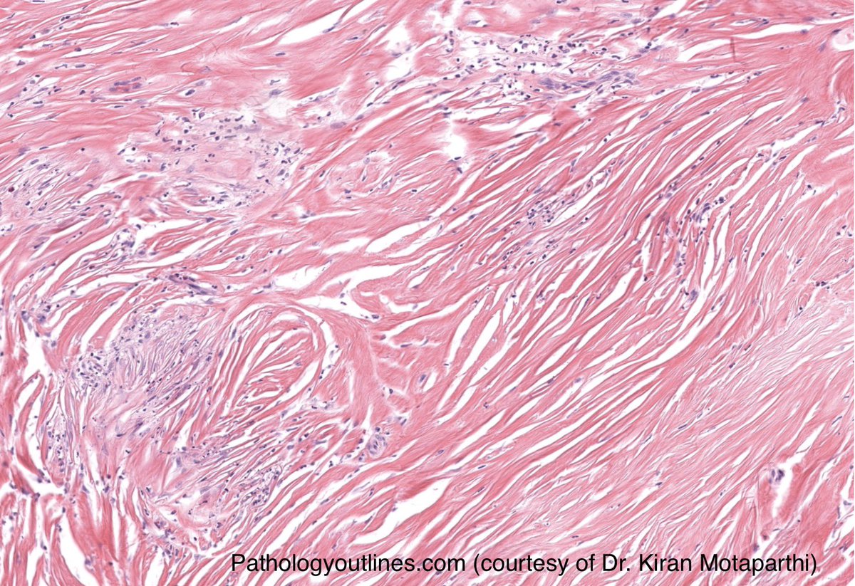 HovAsh3's tweet photo. Question #4! Answers posted the following day. #dermtwitter #dermatology #meded #MedTwitter https://t.co/2qIWwUbMnJ