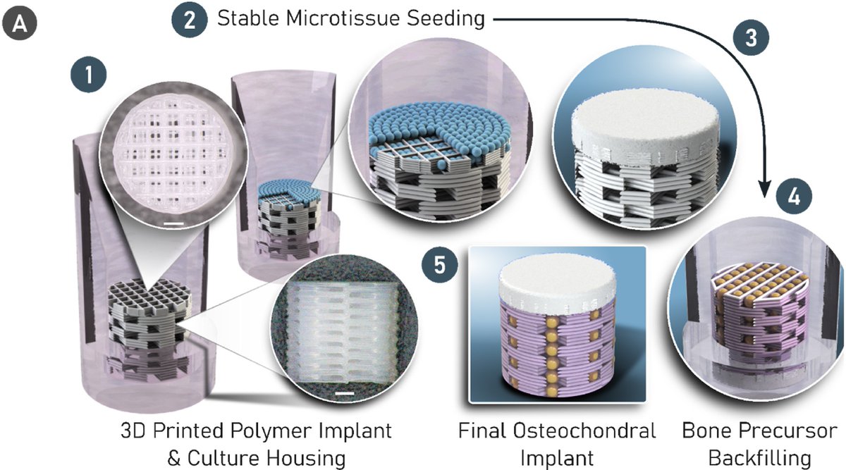 New paper led by <a href="/RossBurdis/">Ross Burdis</a> out in <a href="/Biomaterials_/">Biomaterials</a> 

‘Spatial patterning of phenotypically distinct microtissues to engineer osteochondral grafts for biological joint resurfacing’

doi.org/10.1016/j.biom…

We explore use of microtissues / organoids as biological building blocks⬇️