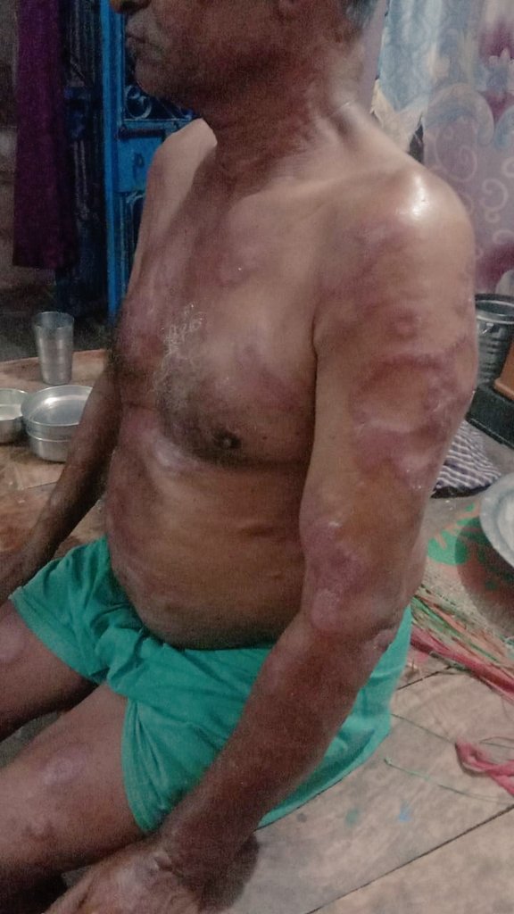 BrijkumarRajput's tweet photo. @UPGovt @myogiadityanath @dm_kannauj Dear Sir, Need to help required. https://t.co/Ey8d8c05QV