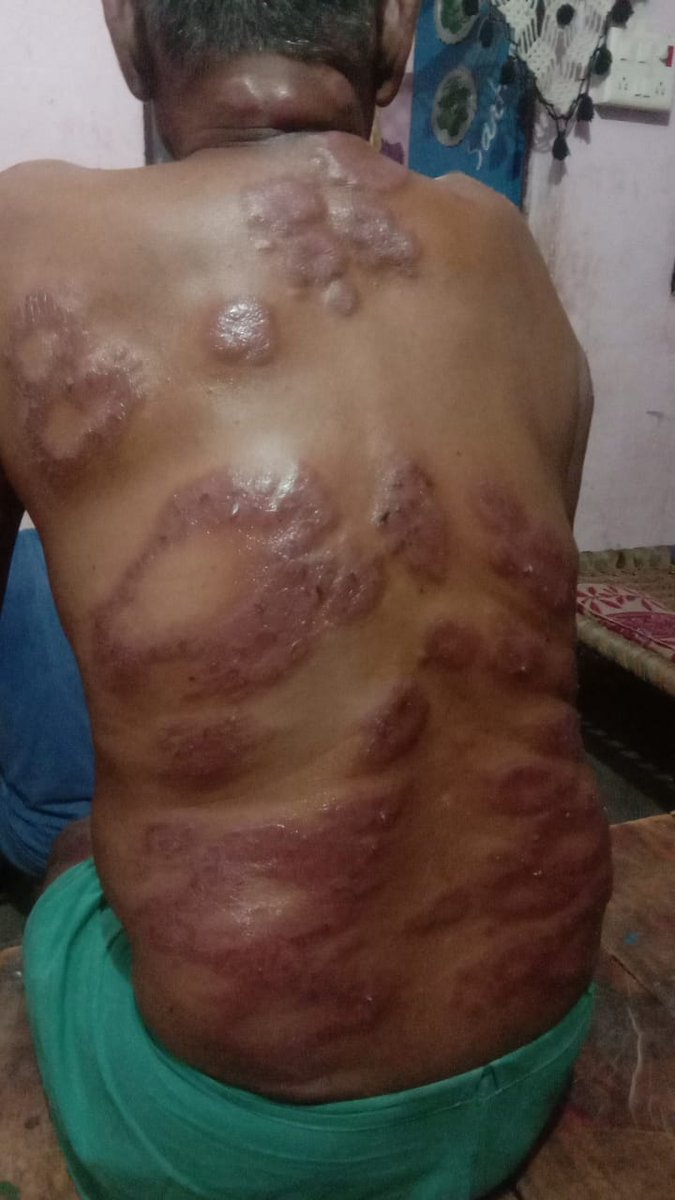 BrijkumarRajput's tweet photo. @UPGovt @myogiadityanath @dm_kannauj Dear Sir, Need to help required. https://t.co/Ey8d8c05QV
