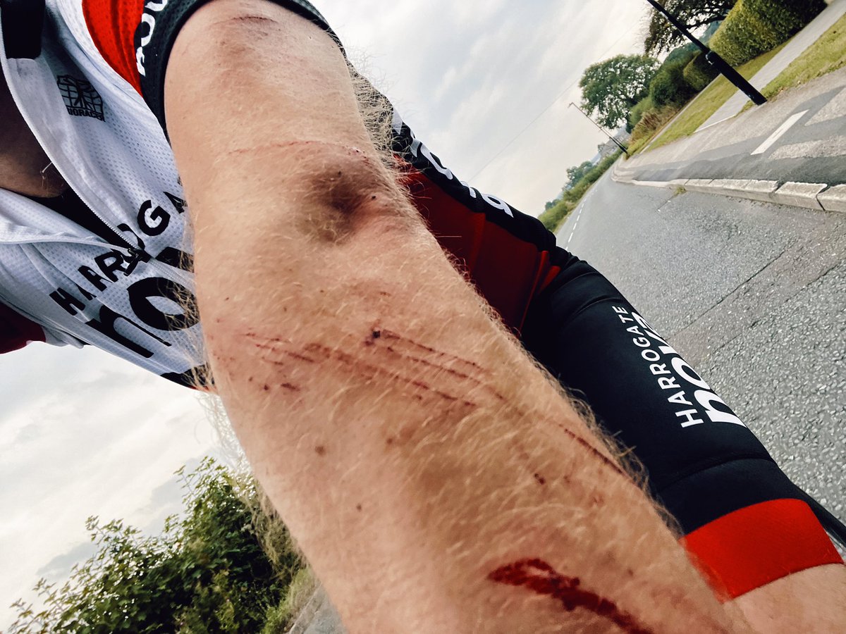 Peter Lorence tweet media