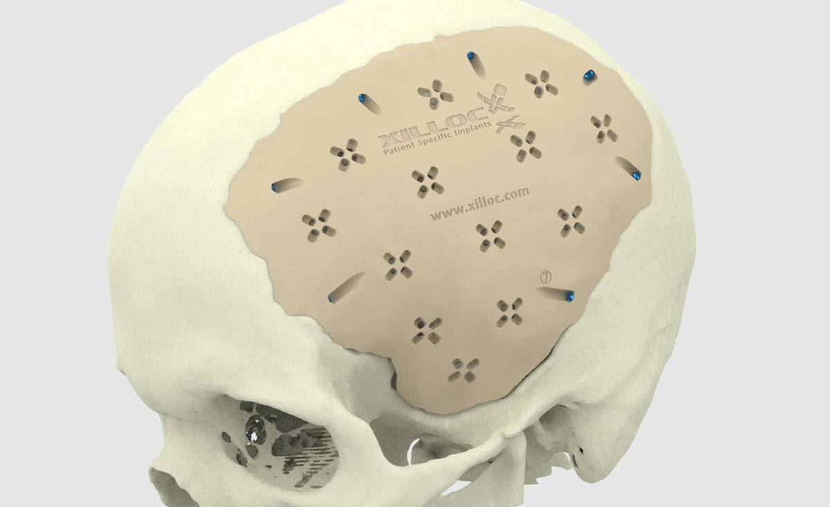 Idea: 3D printing of cartilage and bone
ideamill.info/3d-printing-of…

 #ideas,#3D-printing,#additive,#biology,#body,#bone,#bones,#cartilage,#health,#medicine,#ideamill,#idea