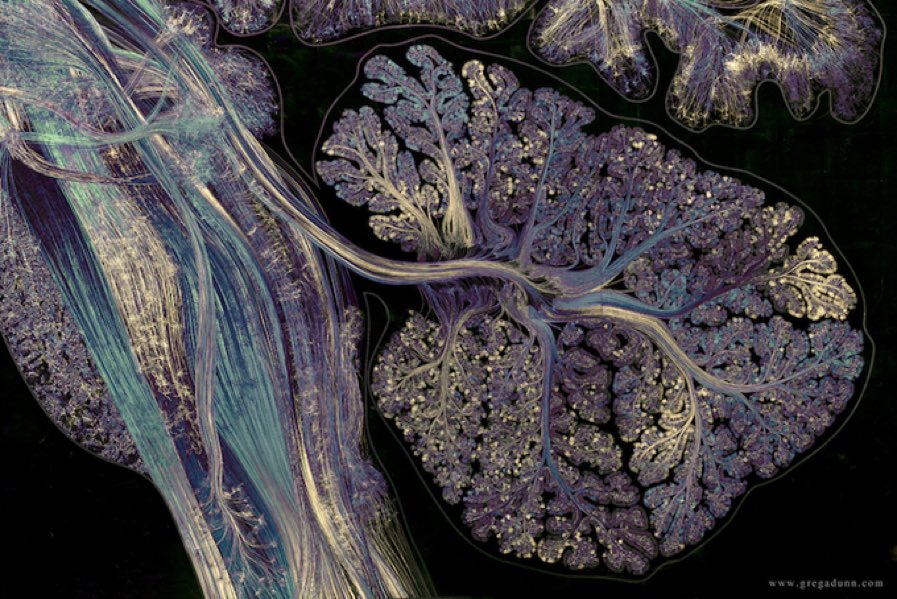 chrost_hugo's tweet photo. The cerebellum contains over 50% of the total number of neurons in the brain and is mostly involved in motor coordination and proprioception.
by G. Dunn
#neuroscience #neurotwitter #sciencetwitter #brain #bioinformatics #neurology #science #anatomy #medicine #MedTwitter https://t.co/04IruyLaDT