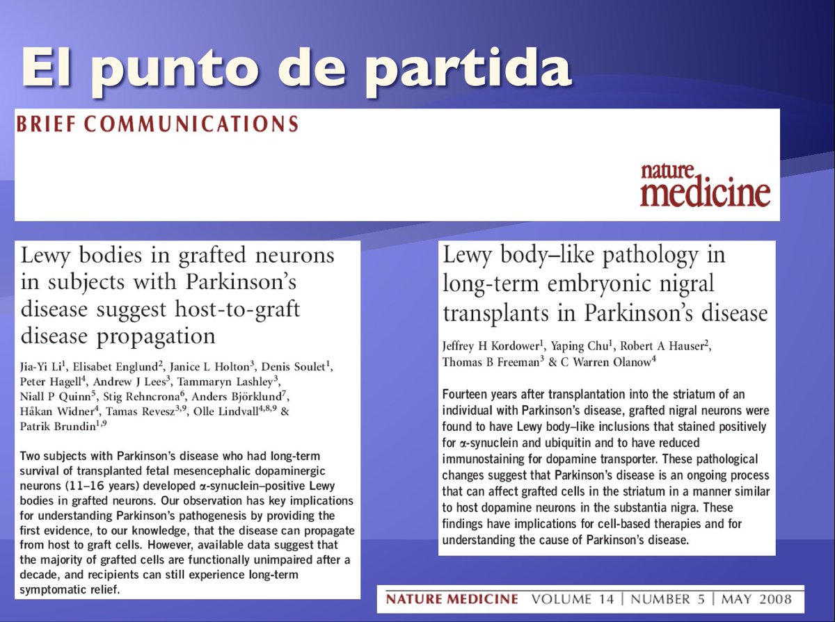 interneurona's tweet photo. @a_charidimou I remembered when #prionic theory came up in #Parkinson disease, after founding Lewy body-like pathology in grafted neurons
#alfasynuclein
@AlbertoEspay is this theory buried? https://t.co/w8VwSkOxph