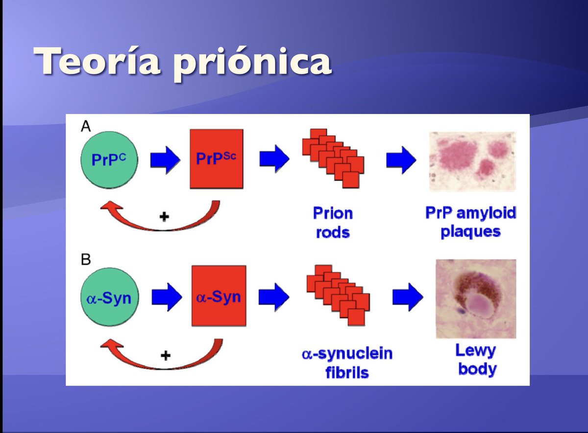 interneurona's tweet photo. @a_charidimou I remembered when #prionic theory came up in #Parkinson disease, after founding Lewy body-like pathology in grafted neurons
#alfasynuclein
@AlbertoEspay is this theory buried? https://t.co/w8VwSkOxph