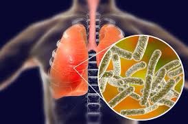 Juanma_serna's tweet photo. Abro hilo sobre la Legionella https://t.co/BCMOee2PDO