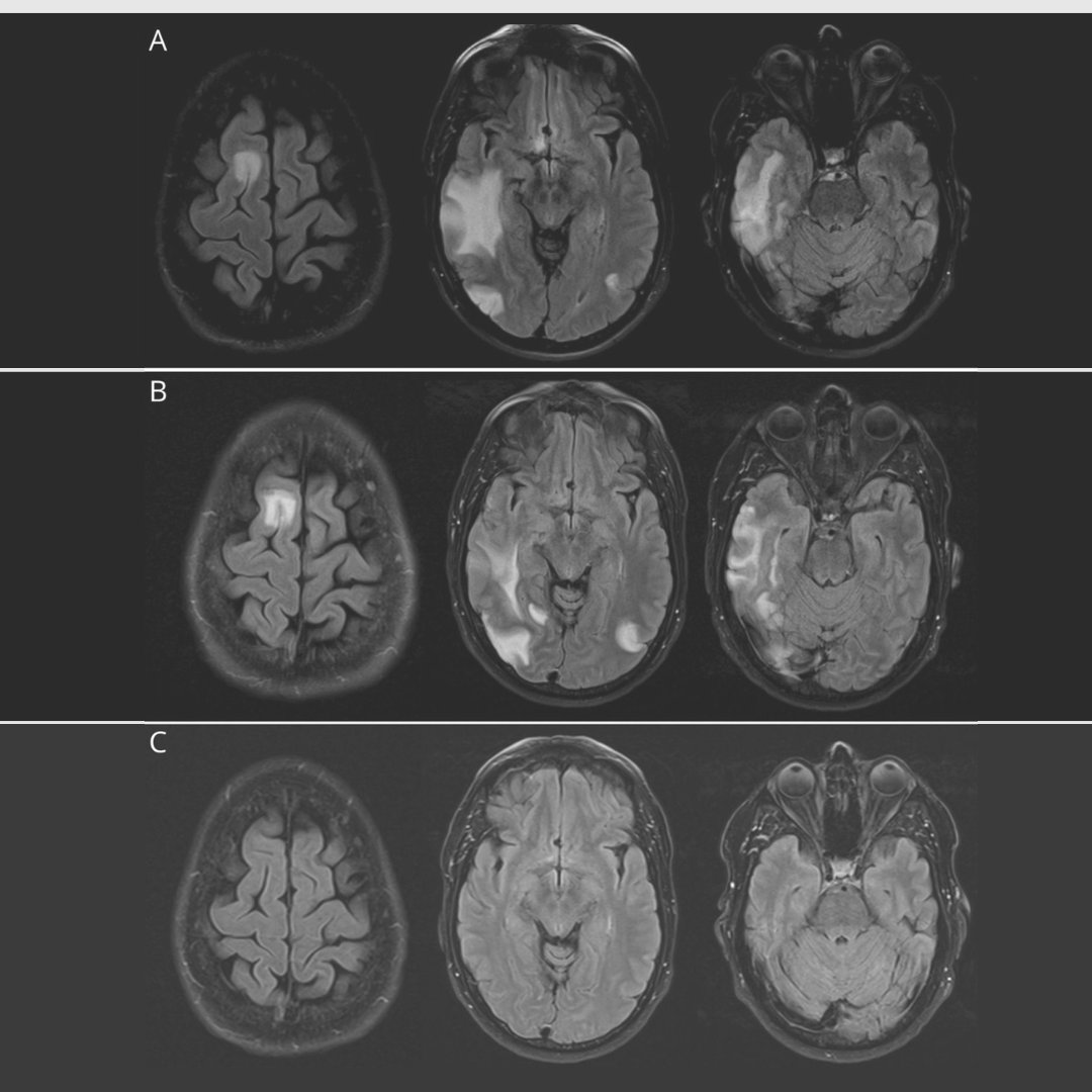 David Ezpeleta on Twitter "RT GreenJournal Hoshina et al. highlight