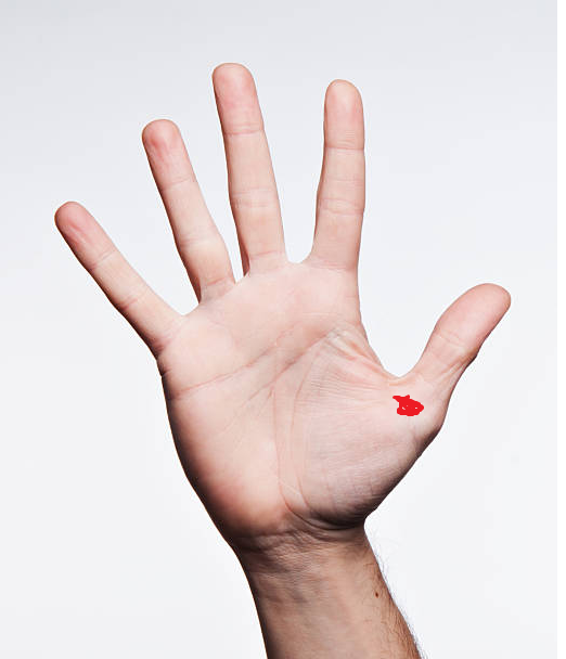 Anyone have/had experience with back side of the mouse hitting bone (nerve?) like on the pic? It's been like 2 weeks I can't aim for longer than 10 minutes without my right thumb fingertip going numb