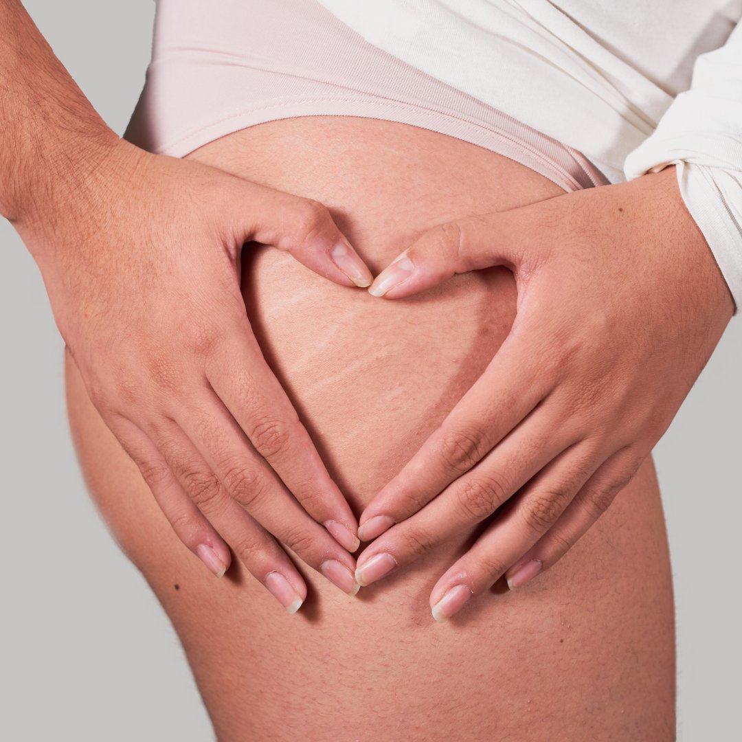 PFT_courses's tweet photo. We're so sick of seeing only perfection on social media - creating an unhealthy environment full of unattainable standards for women!⁠
⁠
It's time to embrace your body, with all its 'flaws' and beauty 💜😊
        
https://t.co/dUP2VZodvO

#purplefeathertree #bekindtoyourself https://t.co/4Y2FZ8LjCq