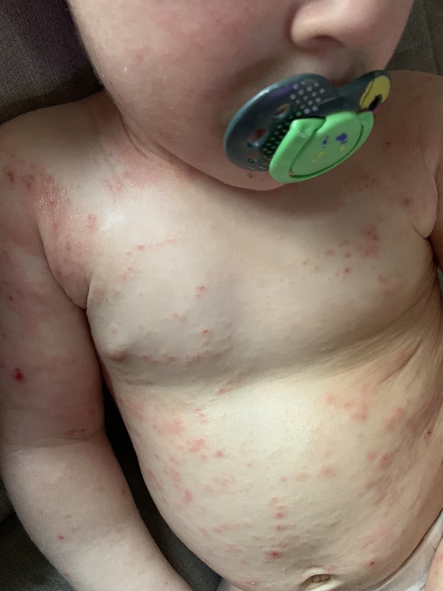 Iain MacLennan tweet media