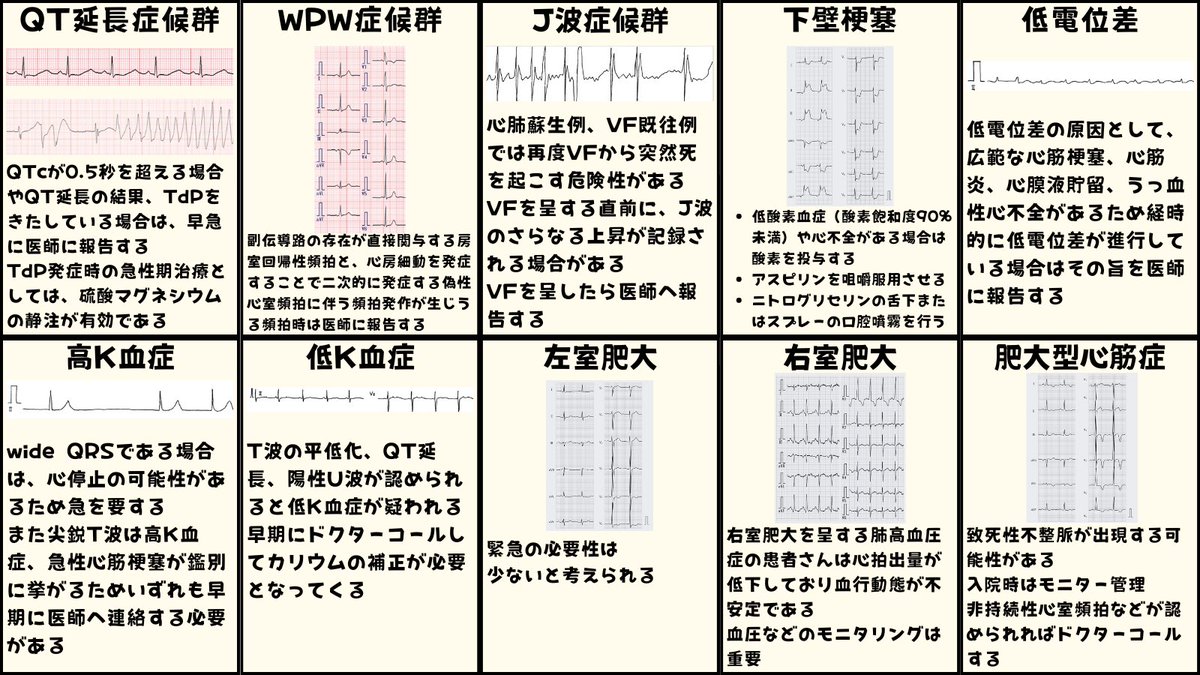 ecgkuma's tweet photo. 心電図40選、何をする？をまとめました。
VF、VT、TdP、偽性VT、af、PSVT、R on T、ST上昇、房室ブロック、洞不全症候群、洞頻脈、洞徐脈、洞不整脈、AFL、期外収縮、ブルガダ、QT延長、WPW、J波、低電位差、高K、低K、心肥大、心筋症、肺血栓塞栓症、右胸心、脚ブロック、たこつぼ、心筋梗塞、心膜炎 https://t.co/jL6GTIgV68