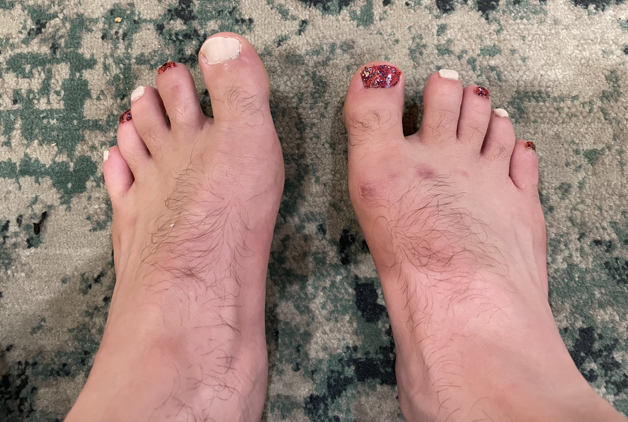 WrighteousJ on Twitter "The pedicure has been abandoned due to nail