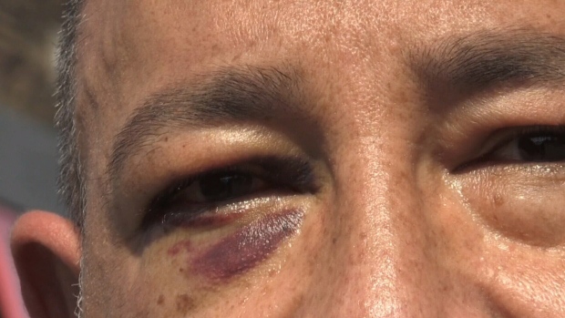 An Ontario pharmacist says he was attacked and targeted simply for providing COVID-19 vaccines. <a href="/CTVStephanieV/">Stephanie Villella</a> reports. bit.ly/3KNgeZb