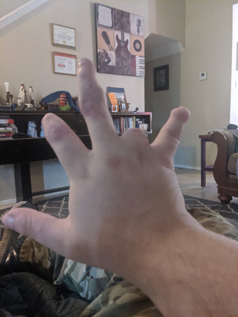 OfAngelaMercy's tweet photo. @marieberd 2/2 what all the screaming was about And whether they should call the cops for a noise complaint. While I was screaming "oh God please someone help me" My next door neighbor was the only one that actually cared and that's only because he knew me. https://t.co/05ZoeFnCyc
