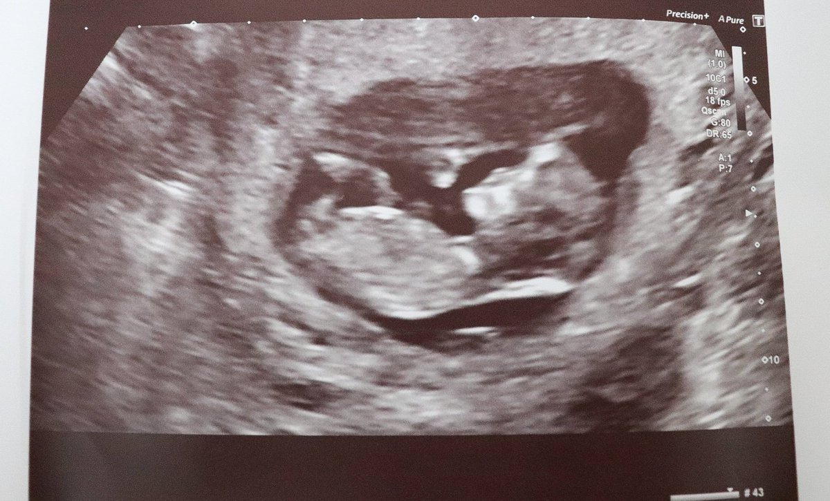MHickmanPhotos's tweet photo. Finally can reveal why I've been quiet on the photography front. Baby Hickman due Feb 2023 ❤ https://t.co/Hjy4sfrK8e
