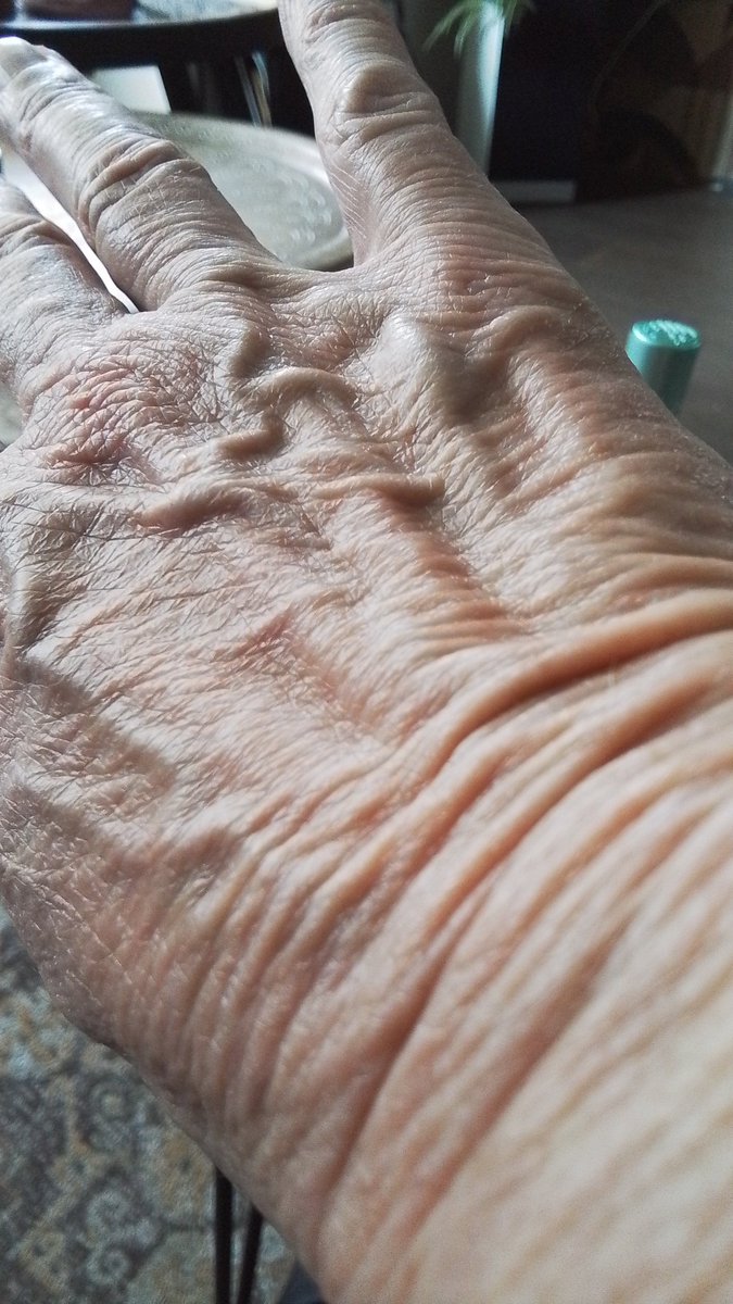 SylvanEd's tweet photo. @GlitterGifjeG Ik heb er veel meer #oldhand https://t.co/PBI910OkXw