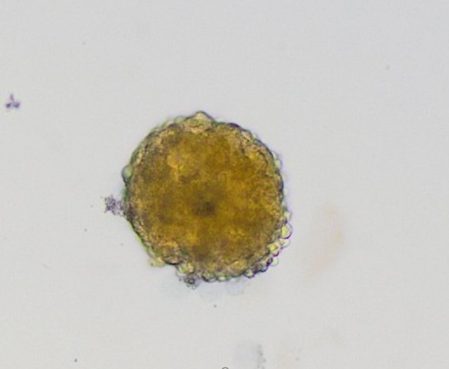SPHERTOX_NIVA's tweet photo. 🧐microscope https://t.co/5sWKWBkkfr
