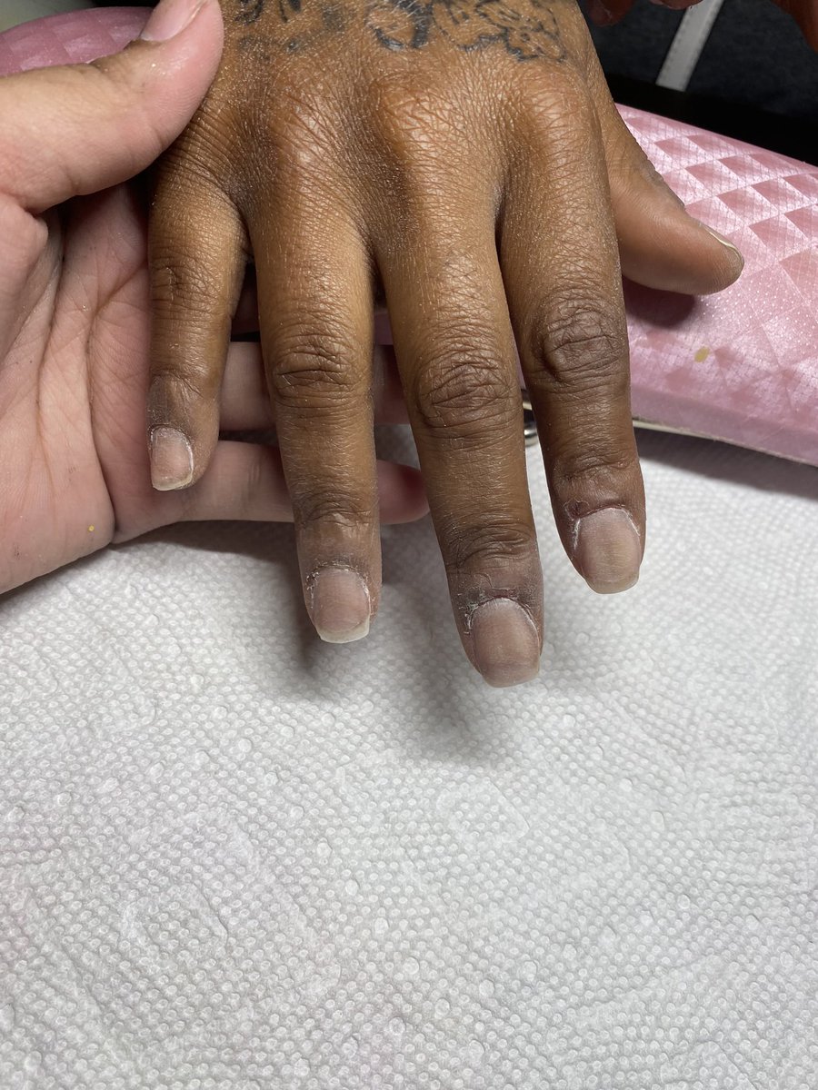 jeweledbyjada's tweet photo. Healthy nails. Perfect soak off.
#jeweledbyjada #okc #okcnails #okcnailtech #oklahomacity #blacknailtech #blackgirlmagic #blackowned #blackownedbusiness #sm3 #explore #nailinspo #naillove #nailaddict #nailart #nailporn #nailjunkie #nailswag #naillife #trendynails https://t.co/1tNnug27Gw