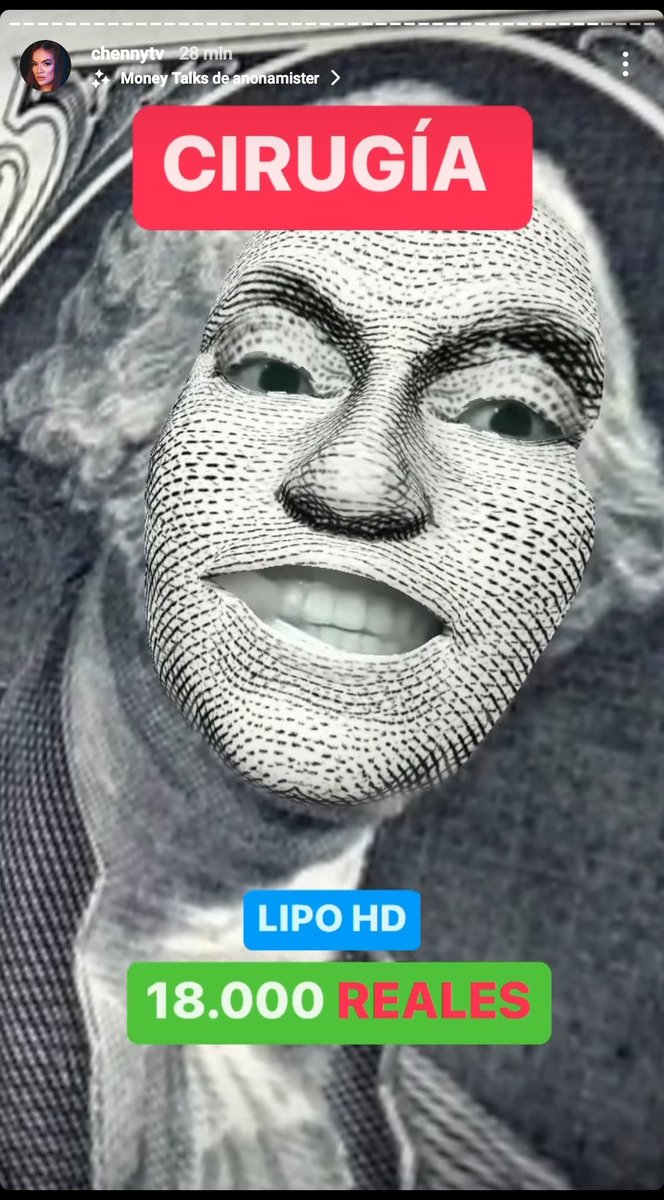 gi_Fleitas's tweet photo. Les hago el resumen de lo que @chennytv gastó en su LIPO HD, incluyendo el post operatorio y la medicación, a estos gastos deben sumarle el costo de las consultas y análisis que se necesitan antes de la operación.
Tomen mucha agua para poder vender a buen precio su riñón.🤣 https://t.co/wgJFULBqRa