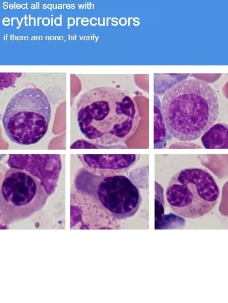 These Captcha are really getting out of hand

#pathtwitter #mematopathology