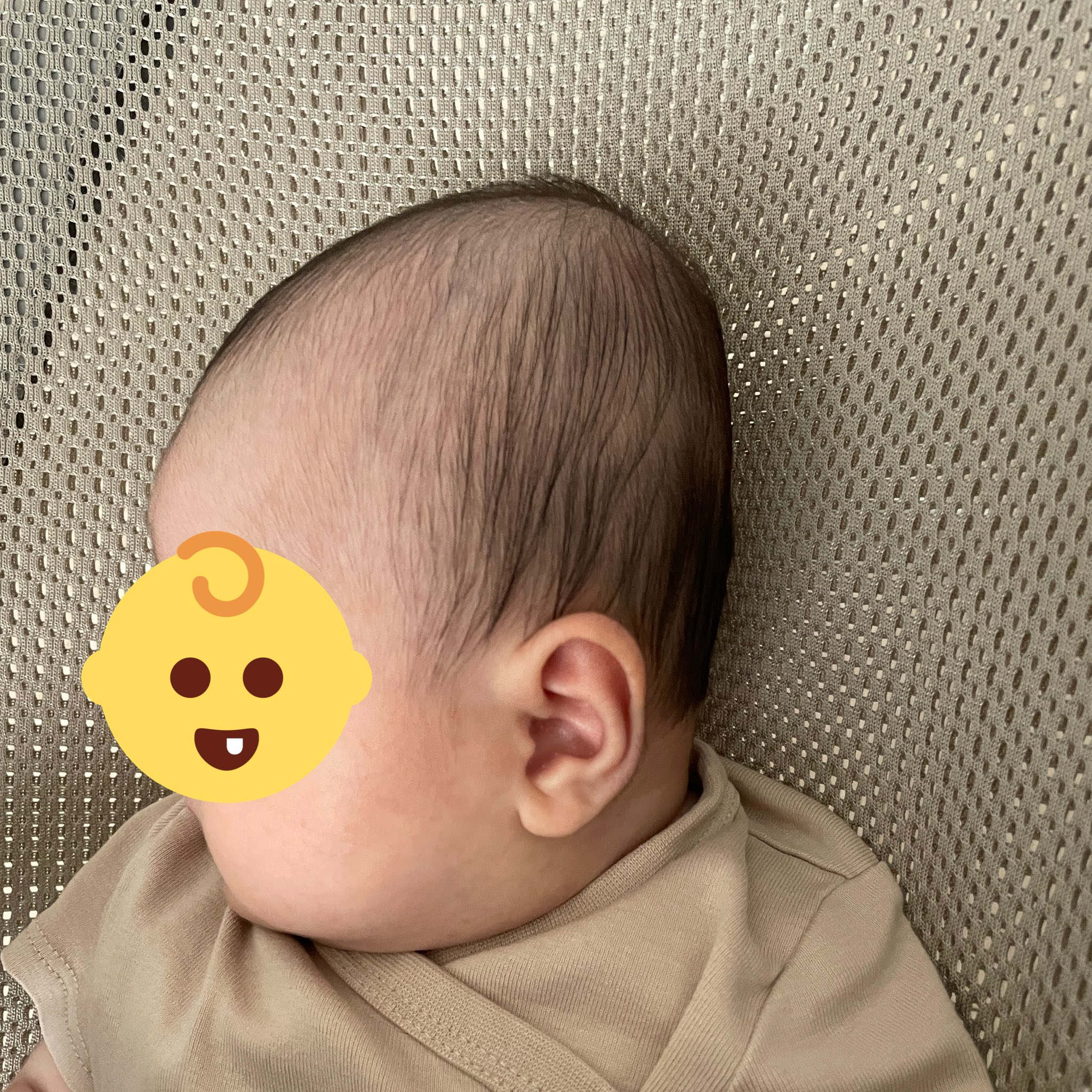 はる 8month 重度って言われた絶壁頭が かなり改善してた 良かった 新生児期から左右交互に向いて寝るようにしてあげたり 首枕で頭の圧を取ってあげるといいそうです 産む前に知りたかった T Co Zj2mijmc9u Twitter