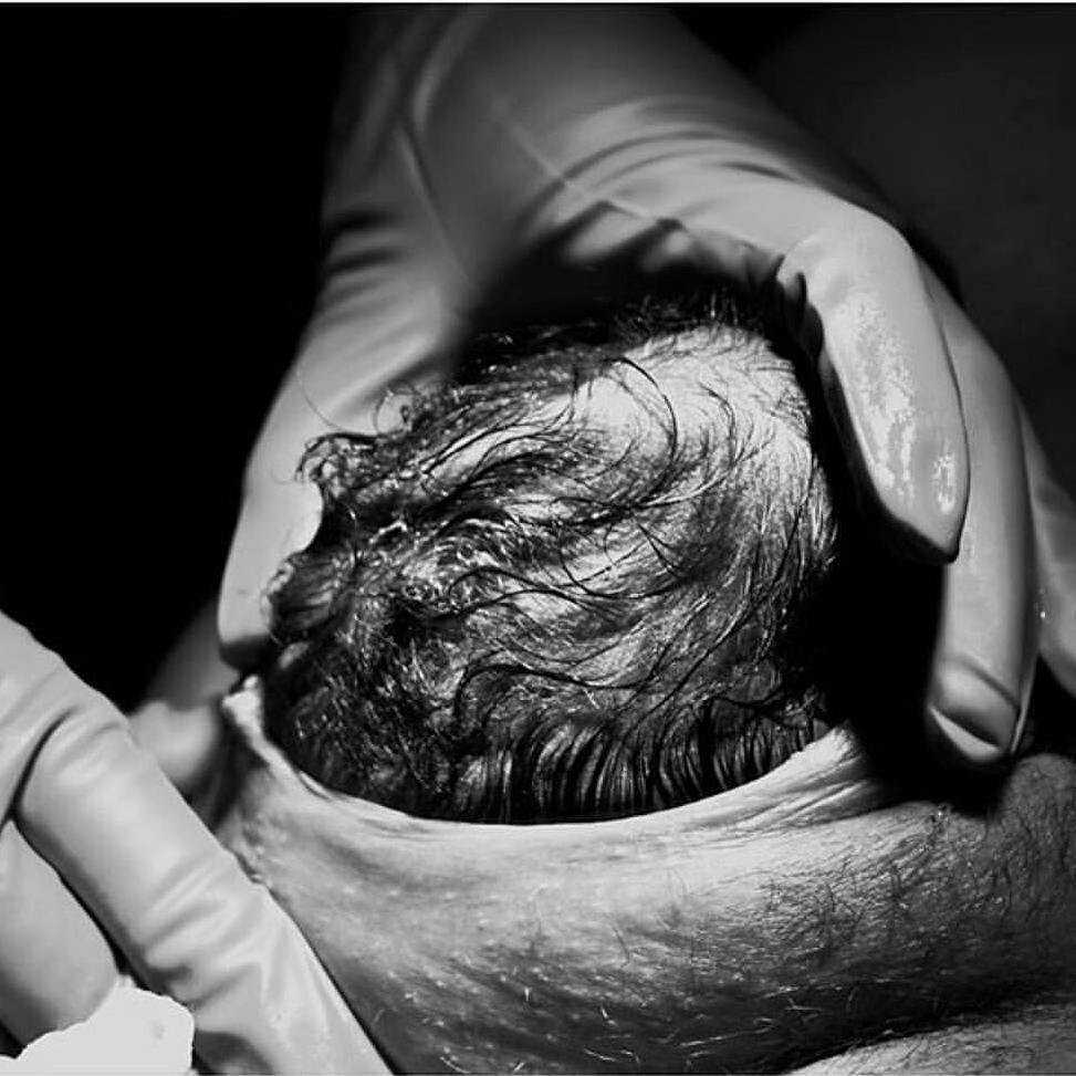GYerathel's tweet photo. Talking about vaginal birth-crowning.

salute to the mother's. give women the respect they deserve!! https://t.co/hm5IjOZ9Ju