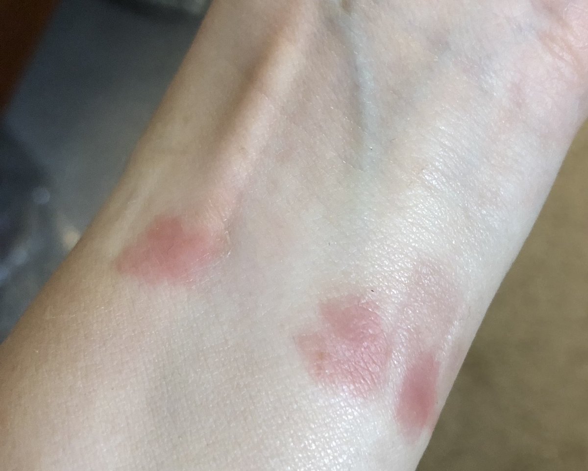 Gluten Free Traveller tweet media