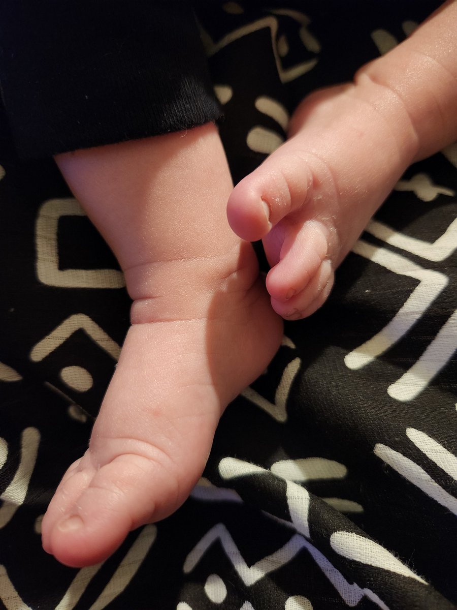 regularxnicole's tweet photo. All in all, im so extremely happy Phineas is here - happy, healthy, HUNGRY. If it wasn't for the incredible reward of seeing his cheeky smiles or hearing his content moans, I'd lose it... more than I already have. https://t.co/GI41m0KfNG