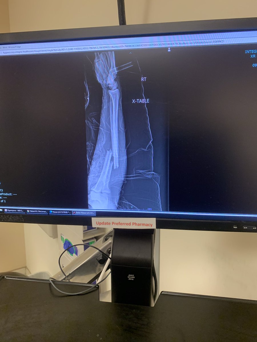 after a game against <a href="/NNFootball/">Norman North Football</a> i have broke my right ulna and radius i wanna thank the yukon staff and everyone that supported me. Its all apart of Gods plan for me 🙏🏽 #10out #gomillers