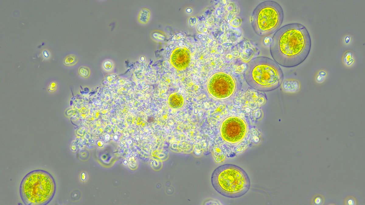jessigserna's tweet image. Hoy es el #InternationalMicroorganismDay así que aprovecho para recordar que la mayoría de los microorganismos son nuestros &quot;amigos&quot; ¡desterremos su mala fama! 🦠🧫🔬 Virus, bacterias, hongos filamentosos, levaduras y protistas que nunca dejan de sorprendernos 😊