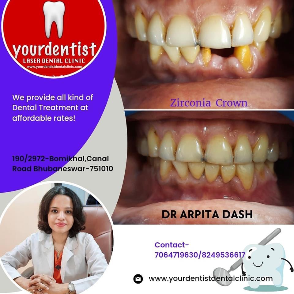 yourdentistpro's tweet photo. Happy Vishwakarma Pooja!
#VishwakarmaPuja #vishwakarmajayanti #drarpitadash #Dentist #yourdentistpro #dentalcare #bestdentalclinic #Bhubaneswar #odisha #bestdentist #Zirconia  #esthetics #Doctor #teethwhitening #dentistry https://t.co/zwZoy0vGf1