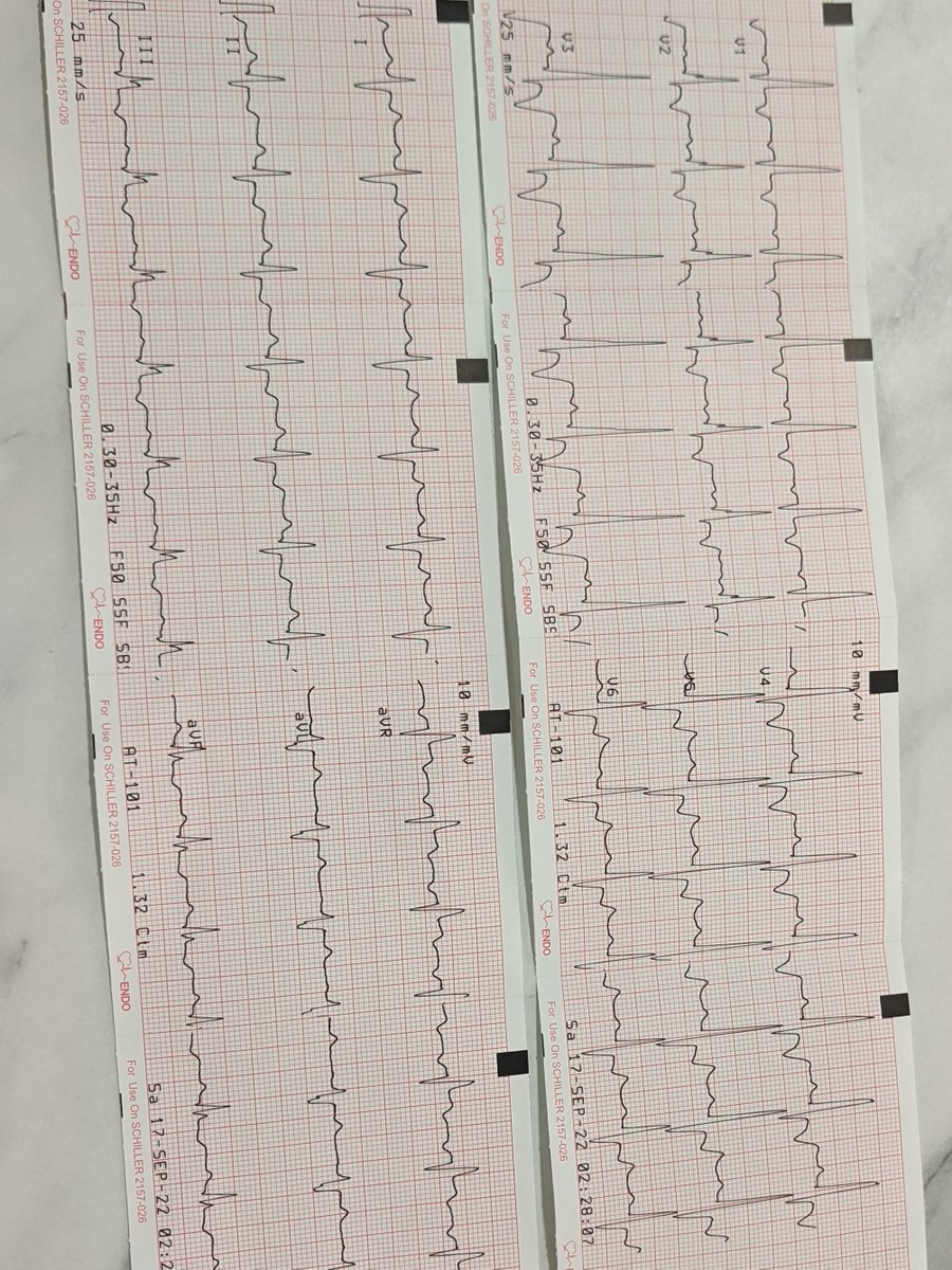 ROYU_ID's tweet photo. jaga kesehatan jantung sejak muda, kalo jantung udh besar gabisa dikecilin lagi, makin besar jantung makin rentan sesak🫀🫀#AcuteCoronarySyndrome https://t.co/w69D6HEBMn